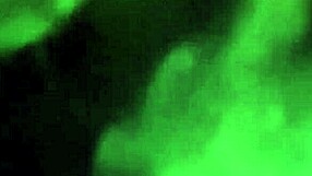 دردشة ودية عن الشفط وبلاجوب مع شيميل متخفي