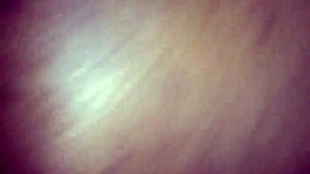 Chocolate Glazed Patient In Hospital With Doctor