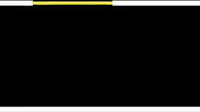 A Redhead Babe Enjoys Asshole Licking in a German Scene