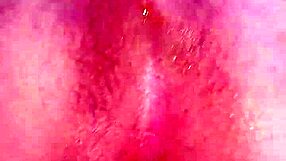 Kolumbijka potřebuje pomoc s anální úzkostí