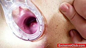 hey, filthy doctor gapes skinny teen's pussy extreme