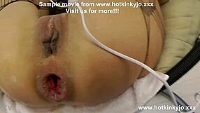 Hotkinkyjo Experiences Anal Fisting Prolapse And Ass Ruined With Huge Dildo On Electric Screwdriver By Alexthorn